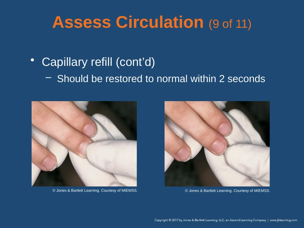 Chapter 9 Patient Assessment National EMS - slide 64 of 177