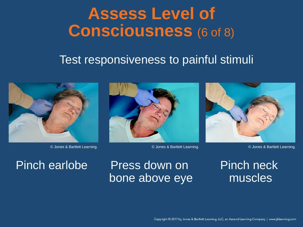 Chapter 9 Patient Assessment National EMS - slide 42 of 177