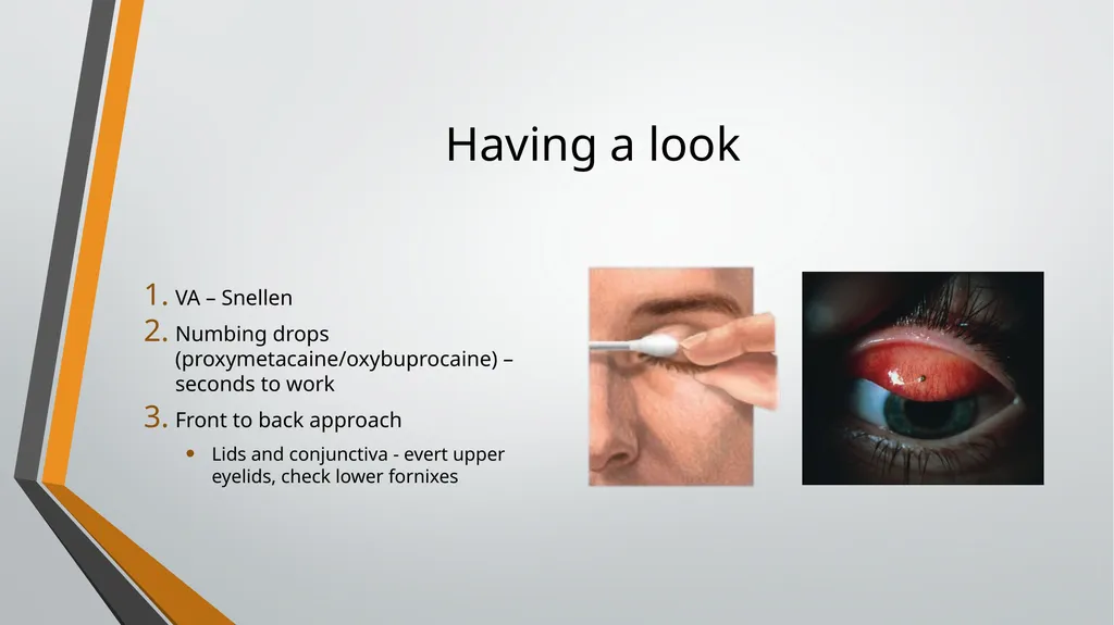 I think I have got something in my eye Foreign - slide 4 of 19