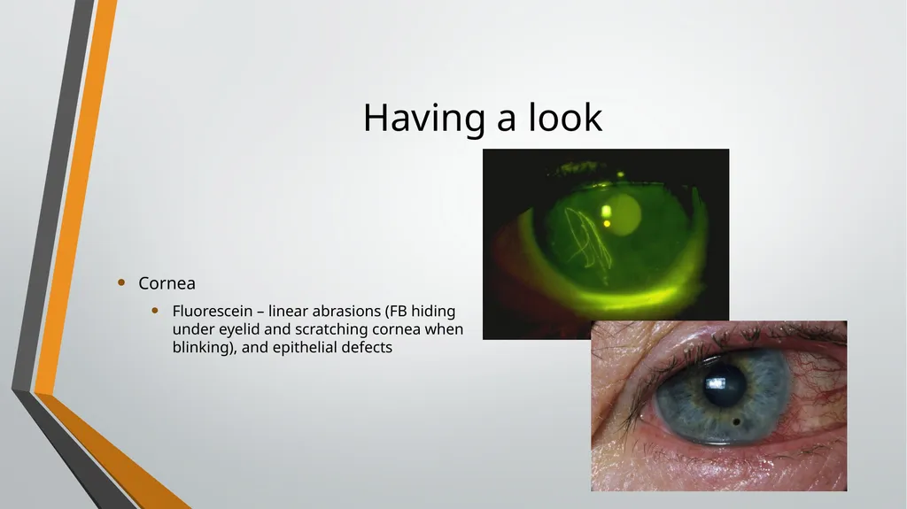 I think I have got something in my eye Foreign - slide 5 of 19