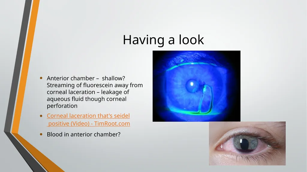 I think I have got something in my eye Foreign - slide 6 of 19