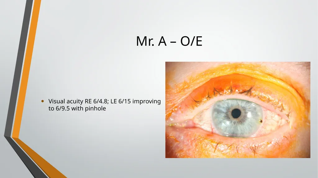 I think I have got something in my eye Foreign - slide 13 of 19