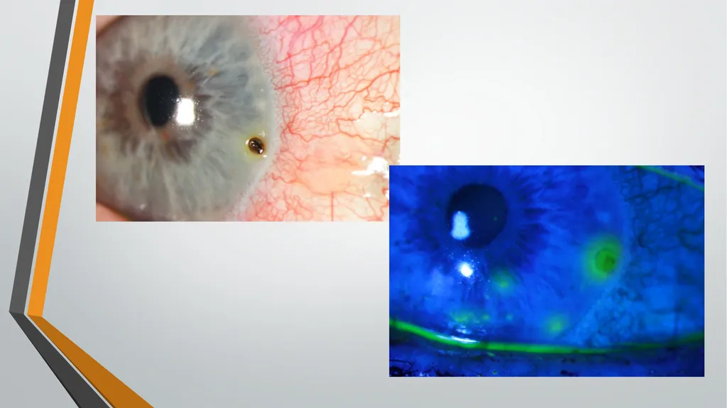 I think I have got something in my eye Foreign - slide 14 of 19