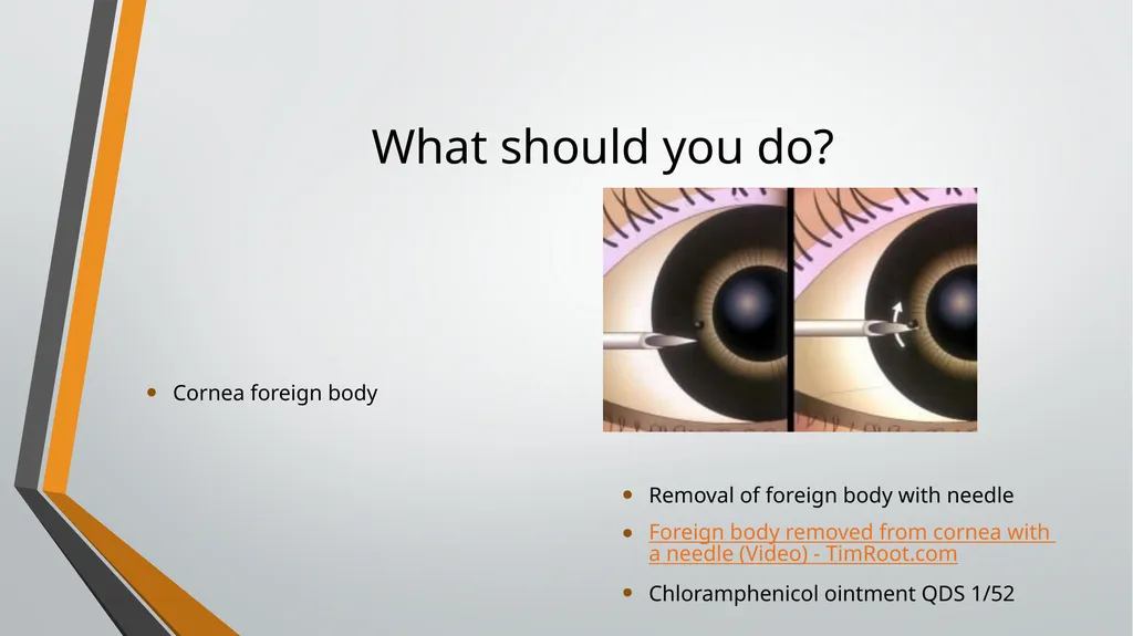 I think I have got something in my eye Foreign - slide 9 of 19