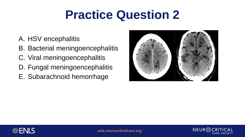 ENLS Version 5.0 Meningitis And Encephalitis - slide 37 of 39