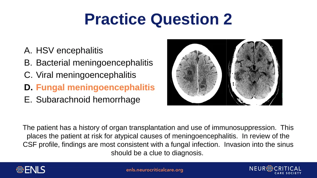 ENLS Version 5.0 Meningitis And Encephalitis - slide 38 of 39