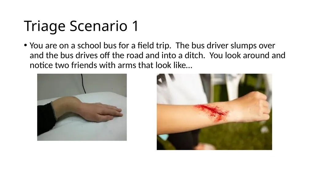 First Aid Merit Badge Session 1 Welcome! - slide 14 of 25