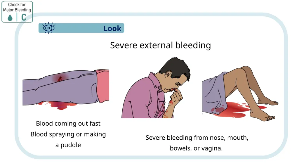 Module 3: CABCDE Approach Community First Aid - slide 9 of 51