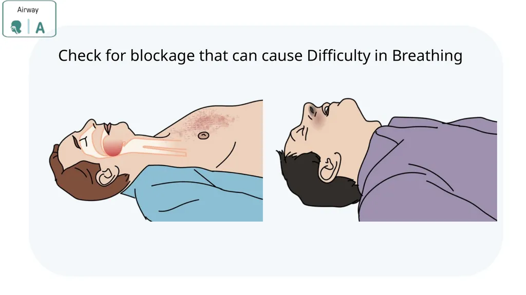 Module 3: CABCDE Approach Community First Aid - slide 12 of 51