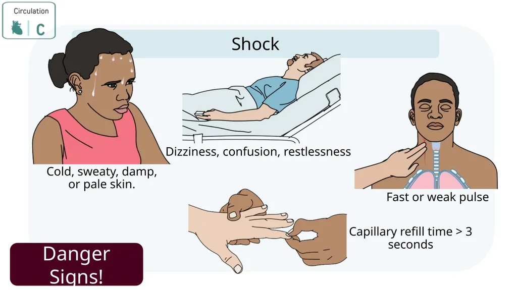 Module 3: CABCDE Approach Community First Aid - slide 26 of 51