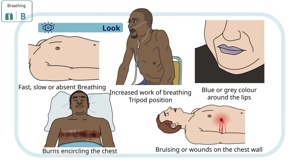 Module 3: CABCDE Approach Community First Aid - slide 20 of 51