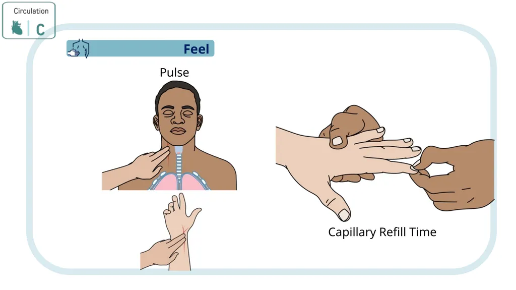 Module 3: CABCDE Approach Community First Aid - slide 28 of 51