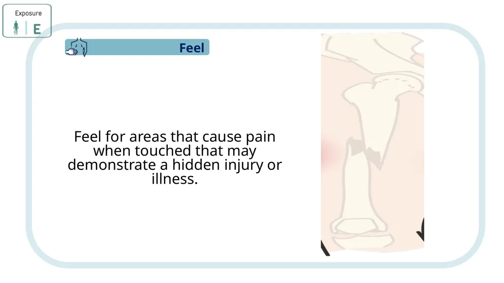 Module 3: CABCDE Approach Community First Aid - slide 44 of 51