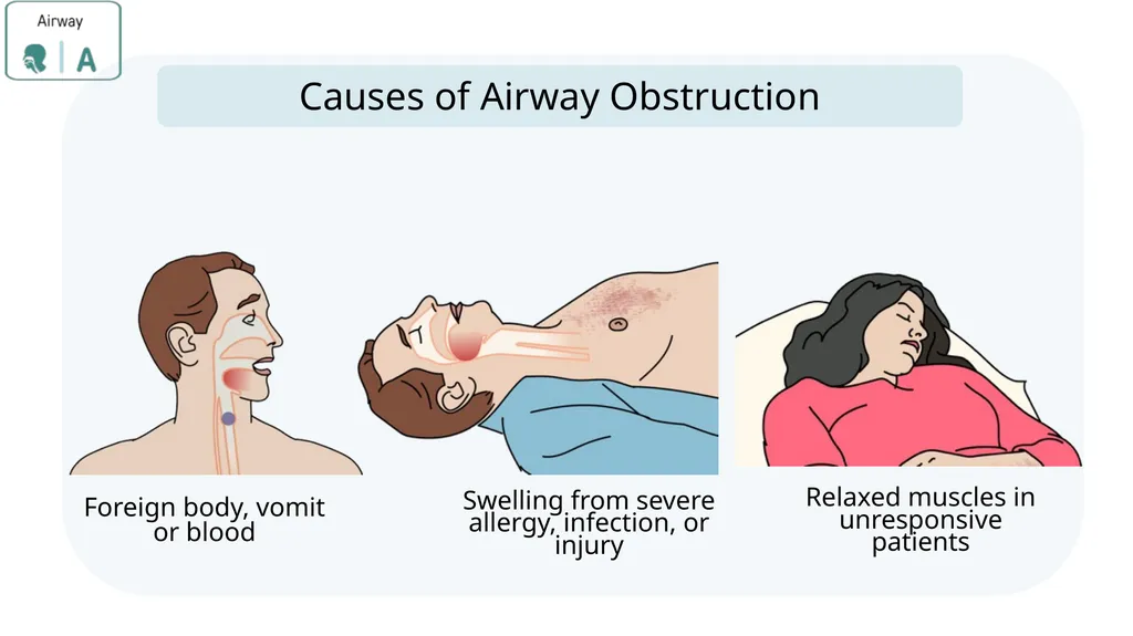 Module 3: CABCDE Approach Community First Aid - slide 13 of 51