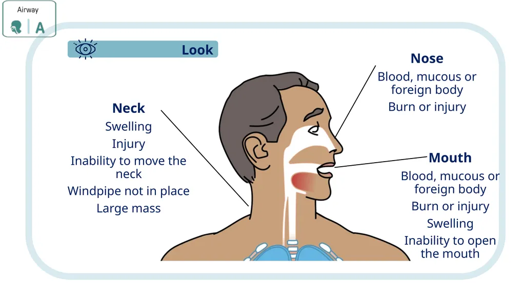 Module 3: CABCDE Approach Community First Aid - slide 14 of 51