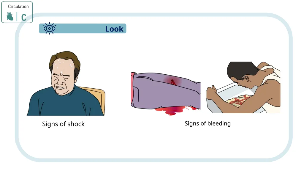 Module 3: CABCDE Approach Community First Aid - slide 27 of 51