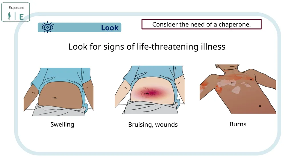 Module 3: CABCDE Approach Community First Aid - slide 43 of 51