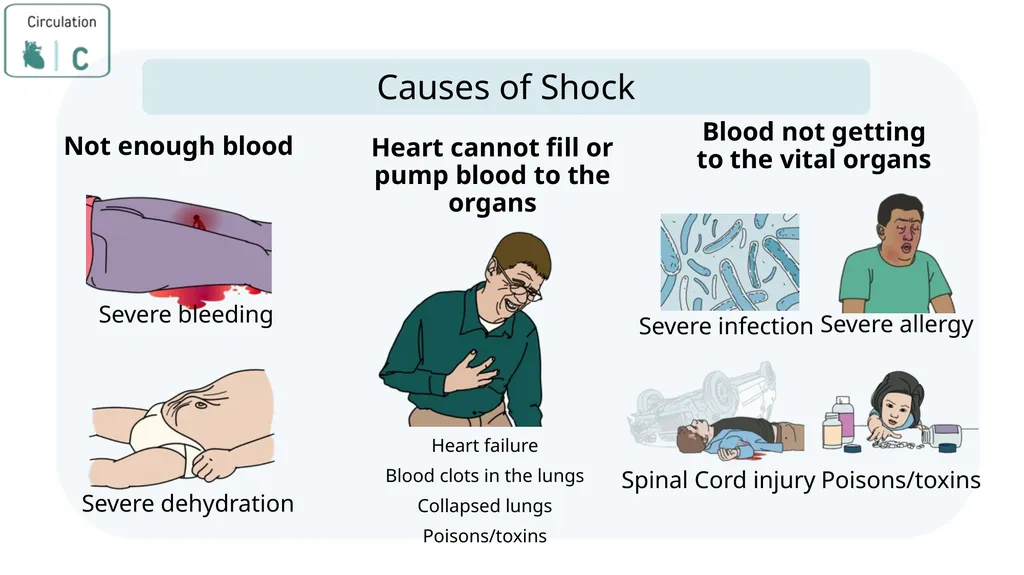Module 3: CABCDE Approach Community First Aid - slide 25 of 51