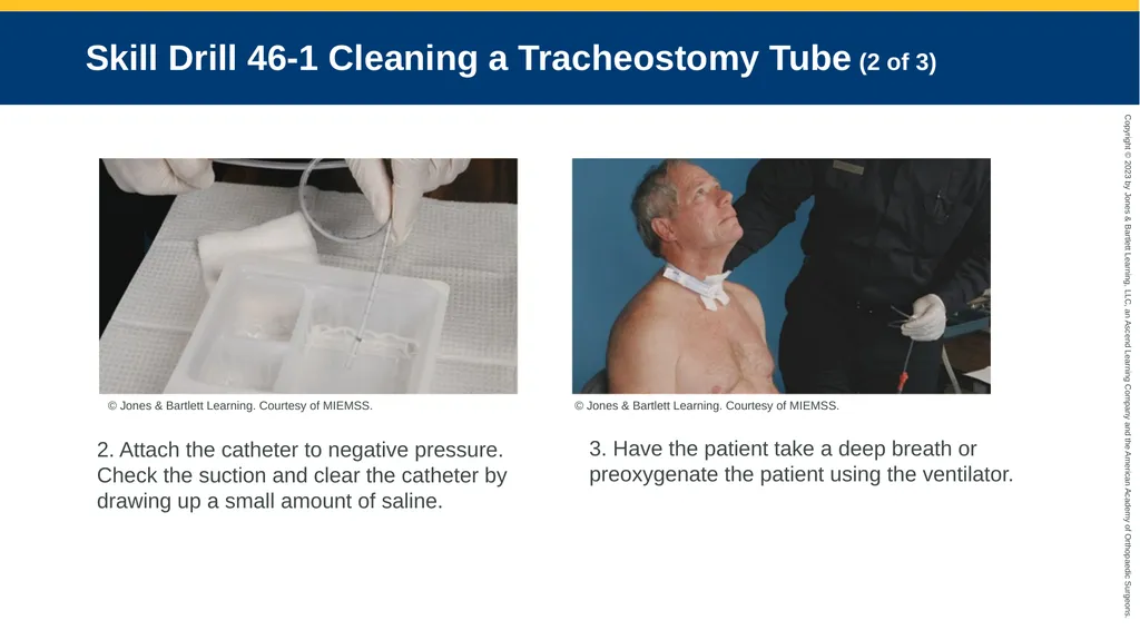 Patients With Special Challenges CHAPTER 46 Skill - slide 3 of 10