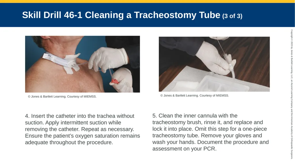 Patients With Special Challenges CHAPTER 46 Skill - slide 4 of 10