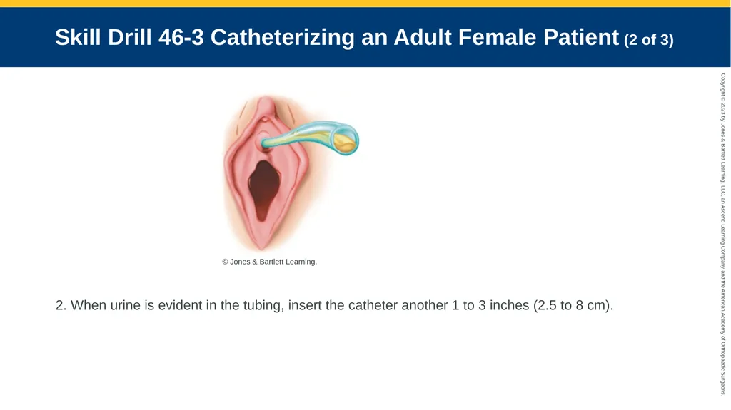 Patients With Special Challenges CHAPTER 46 Skill - slide 9 of 10