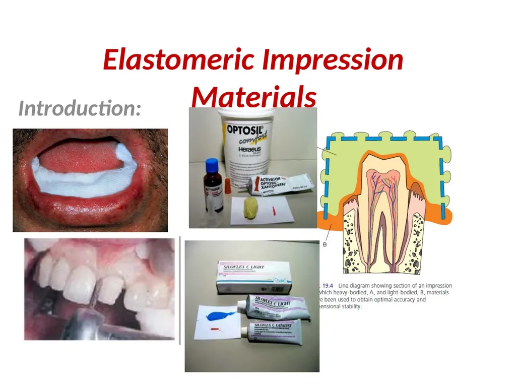 Elastomeric Impression Materials Dr. Manar Nazhat - slide 15 of 24