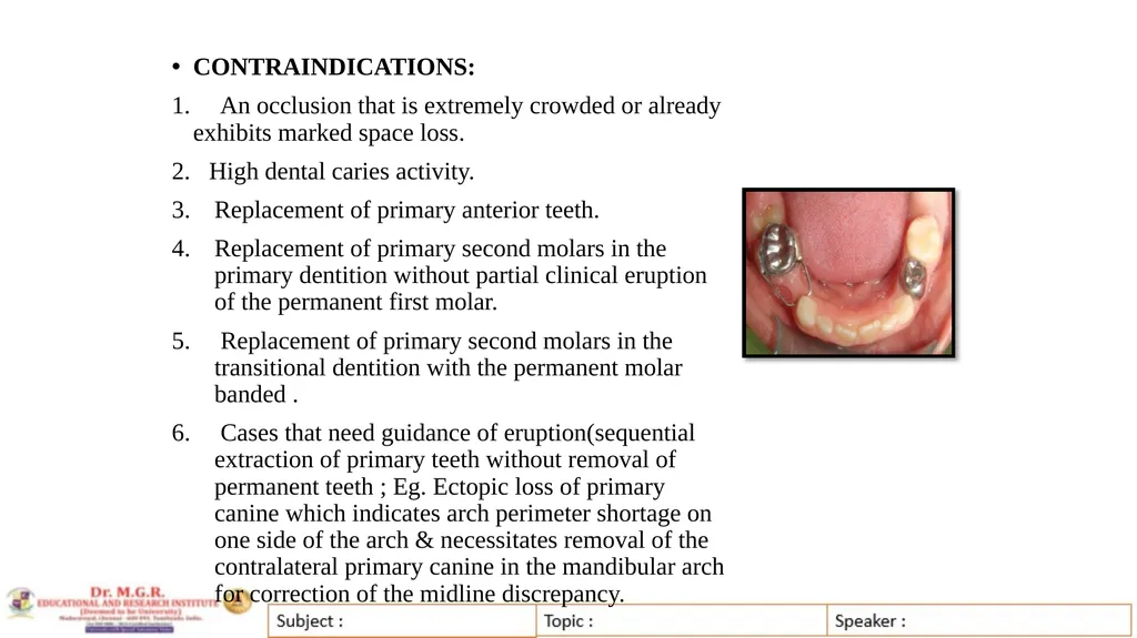 Topic : INTERCEPTIVE ORTHODONTICS-II Subject Code - slide 36 of 56