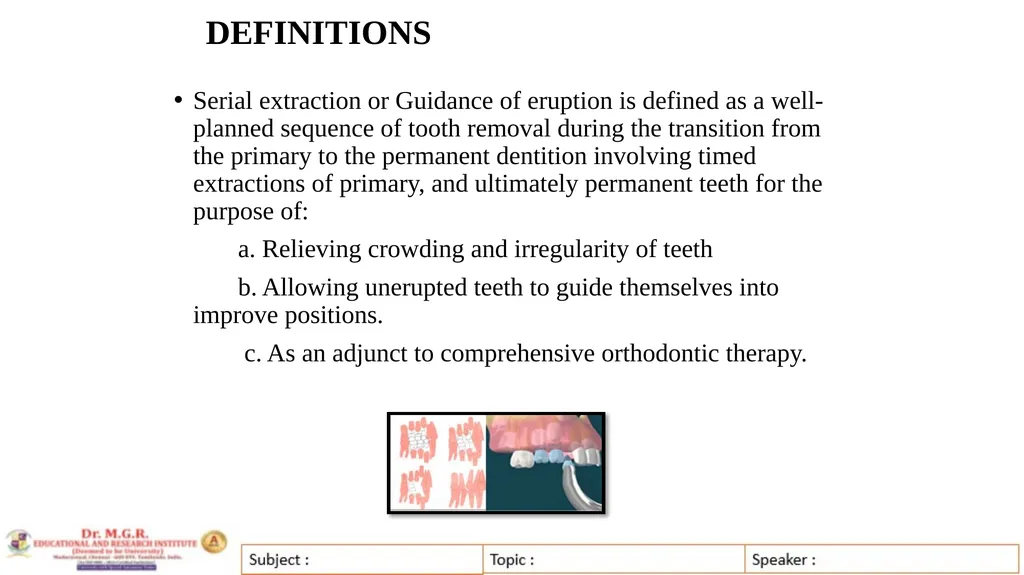Topic : INTERCEPTIVE ORTHODONTICS-II Subject Code - slide 5 of 56