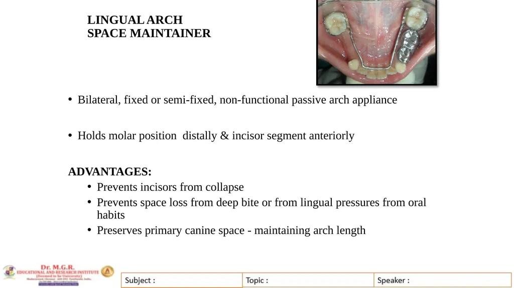 Topic : INTERCEPTIVE ORTHODONTICS-II Subject Code - slide 41 of 56