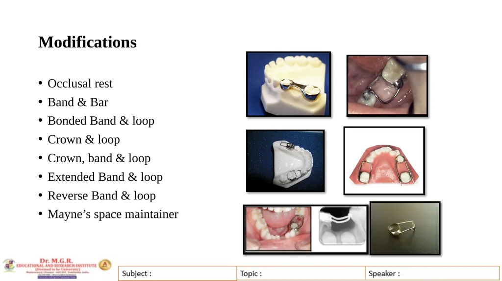 Topic : INTERCEPTIVE ORTHODONTICS-II Subject Code - slide 40 of 56