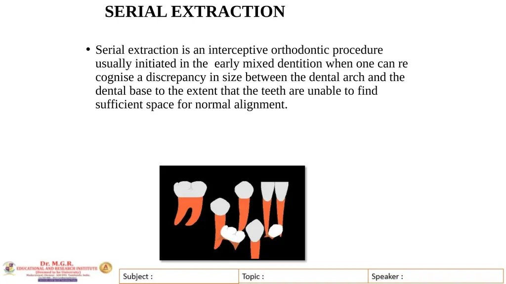 Topic : INTERCEPTIVE ORTHODONTICS-II Subject Code - slide 4 of 56