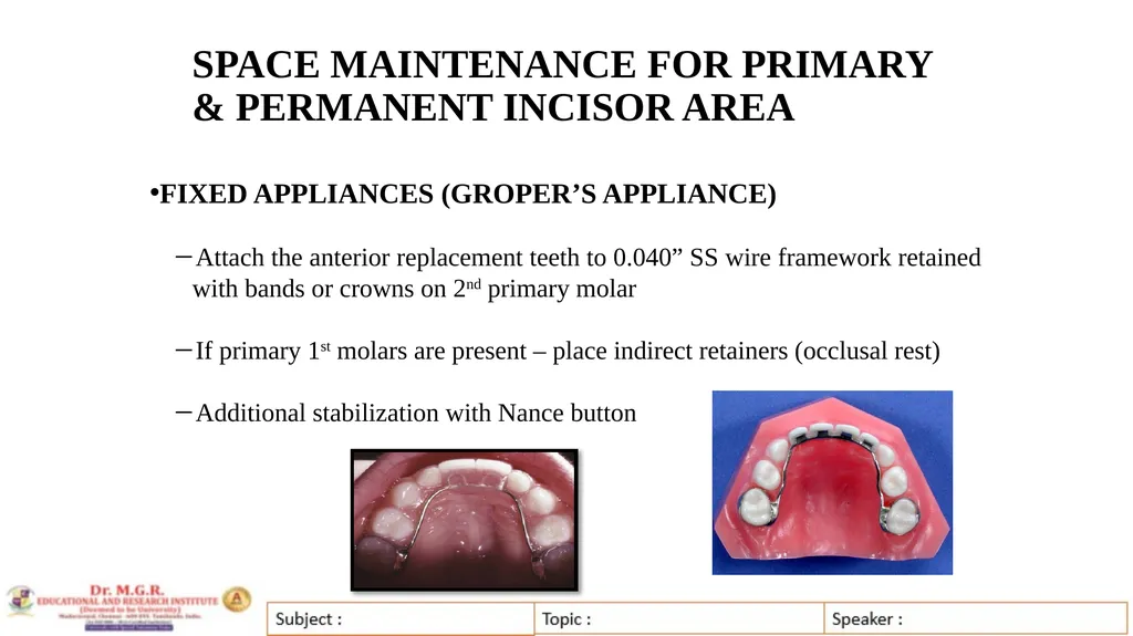 Topic : INTERCEPTIVE ORTHODONTICS-II Subject Code - slide 52 of 56