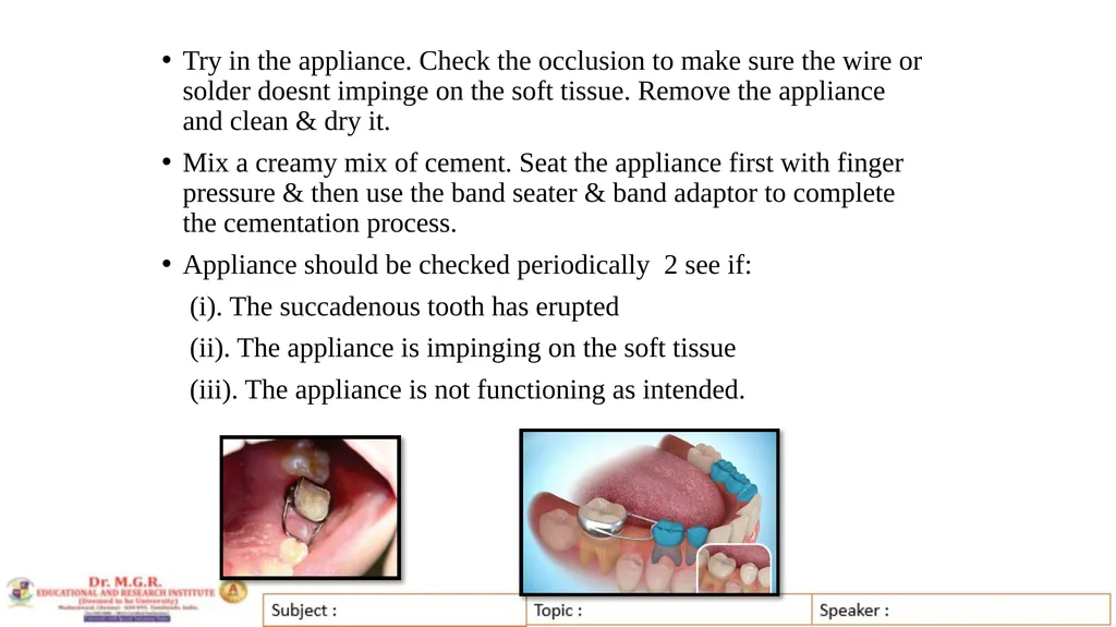 Topic : INTERCEPTIVE ORTHODONTICS-II Subject Code - slide 39 of 56