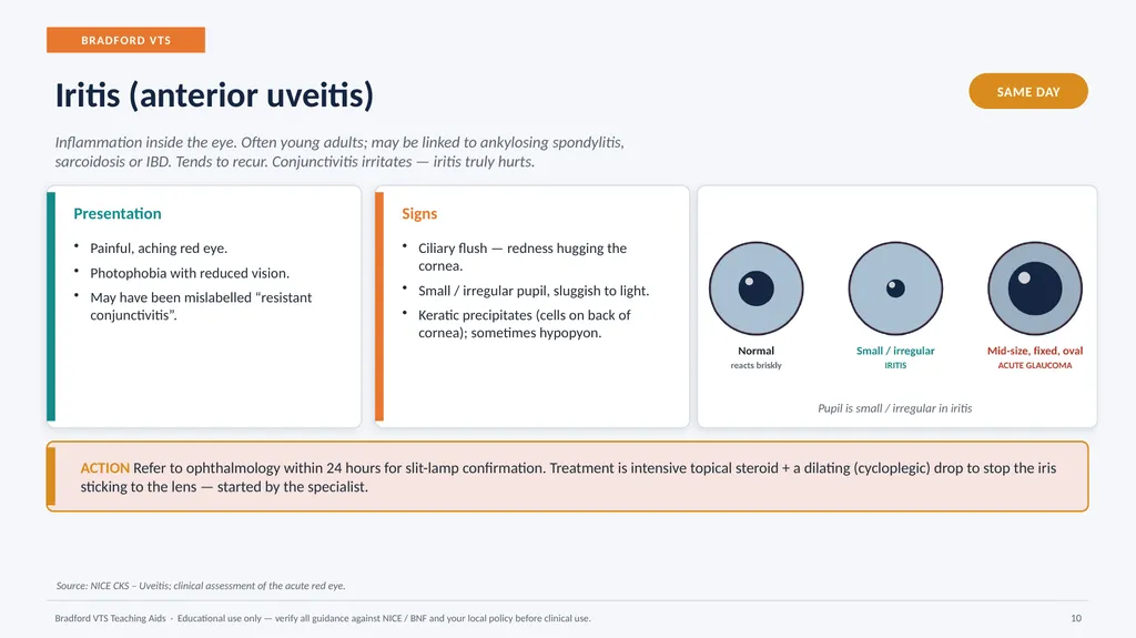 BRADFORD VTS TEACHING AIDS Eye Emergencies in - slide 10 of 36