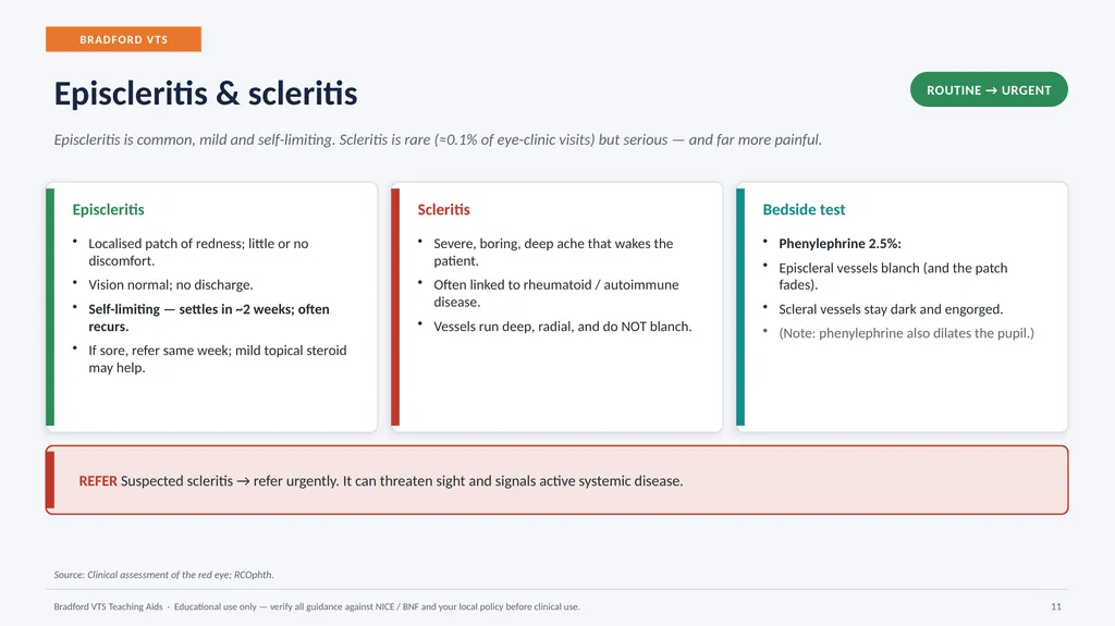 BRADFORD VTS TEACHING AIDS Eye Emergencies in - slide 11 of 36