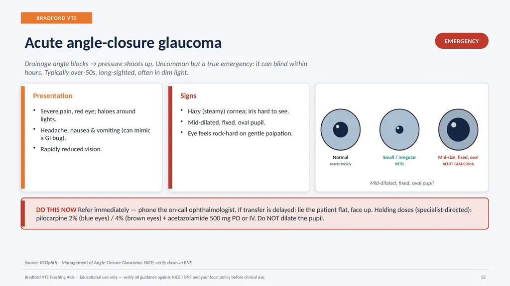 BRADFORD VTS TEACHING AIDS Eye Emergencies in - slide 12 of 36