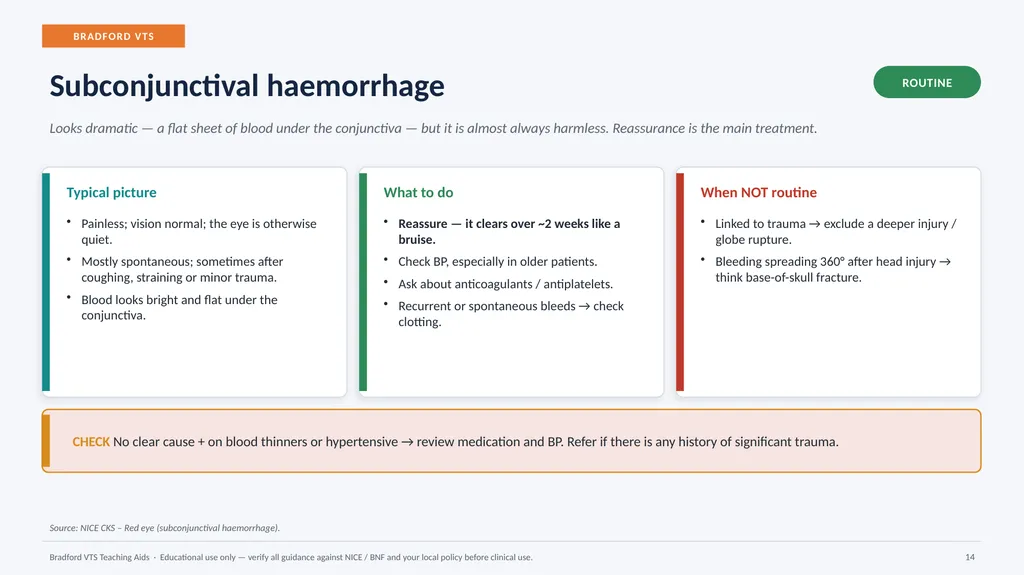 BRADFORD VTS TEACHING AIDS Eye Emergencies in - slide 14 of 36