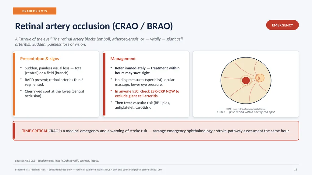 BRADFORD VTS TEACHING AIDS Eye Emergencies in - slide 16 of 36