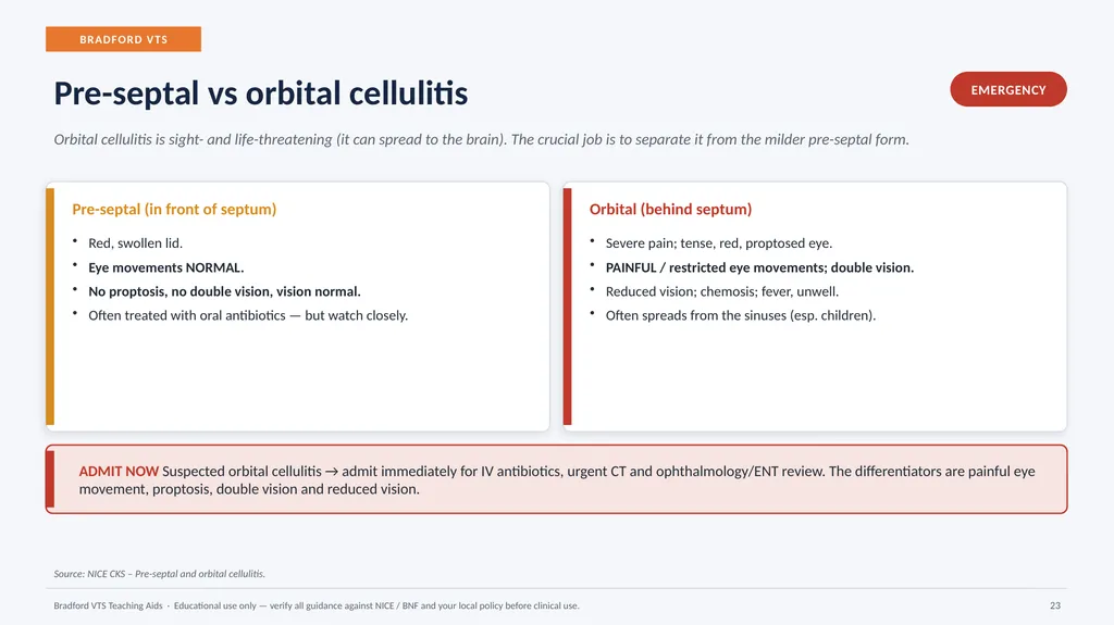 BRADFORD VTS TEACHING AIDS Eye Emergencies in - slide 23 of 36