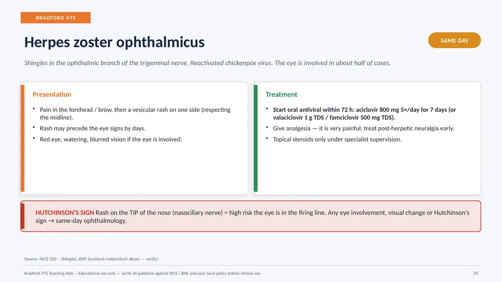 BRADFORD VTS TEACHING AIDS Eye Emergencies in - slide 24 of 36