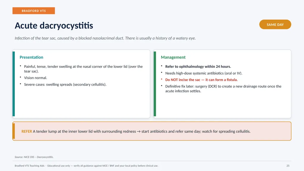 BRADFORD VTS TEACHING AIDS Eye Emergencies in - slide 25 of 36