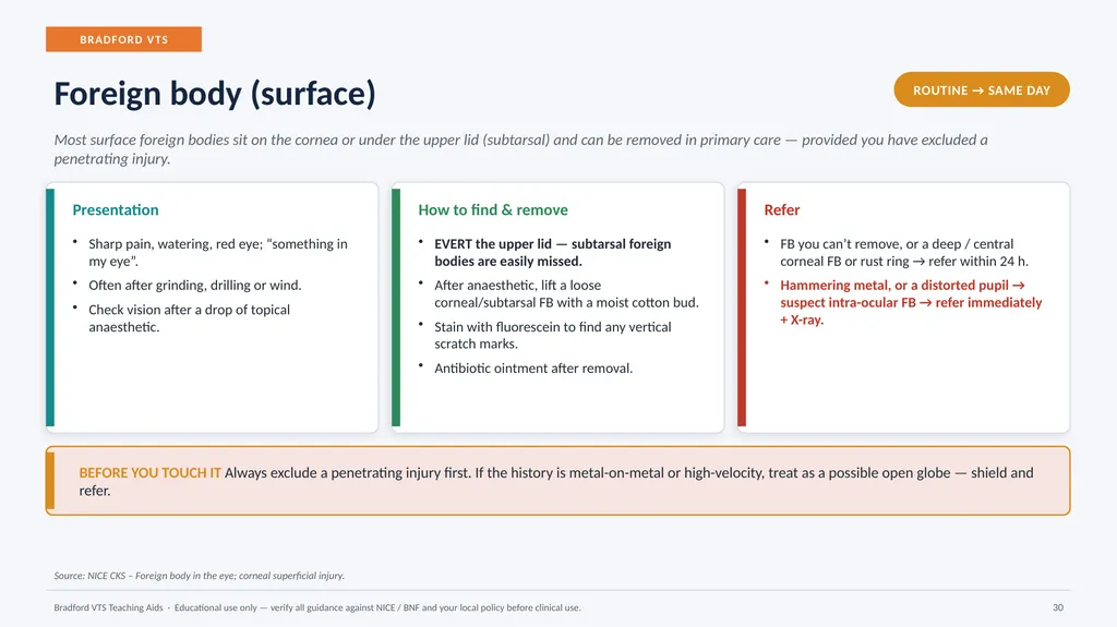 BRADFORD VTS TEACHING AIDS Eye Emergencies in - slide 30 of 36