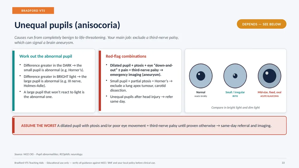 BRADFORD VTS TEACHING AIDS Eye Emergencies in - slide 33 of 36