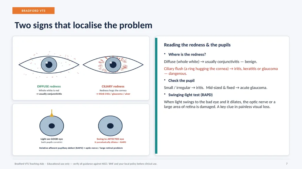 BRADFORD VTS TEACHING AIDS Eye Emergencies in - slide 7 of 36