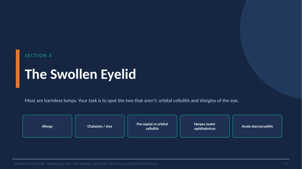 BRADFORD VTS TEACHING AIDS Eye Emergencies in - slide 21 of 36
