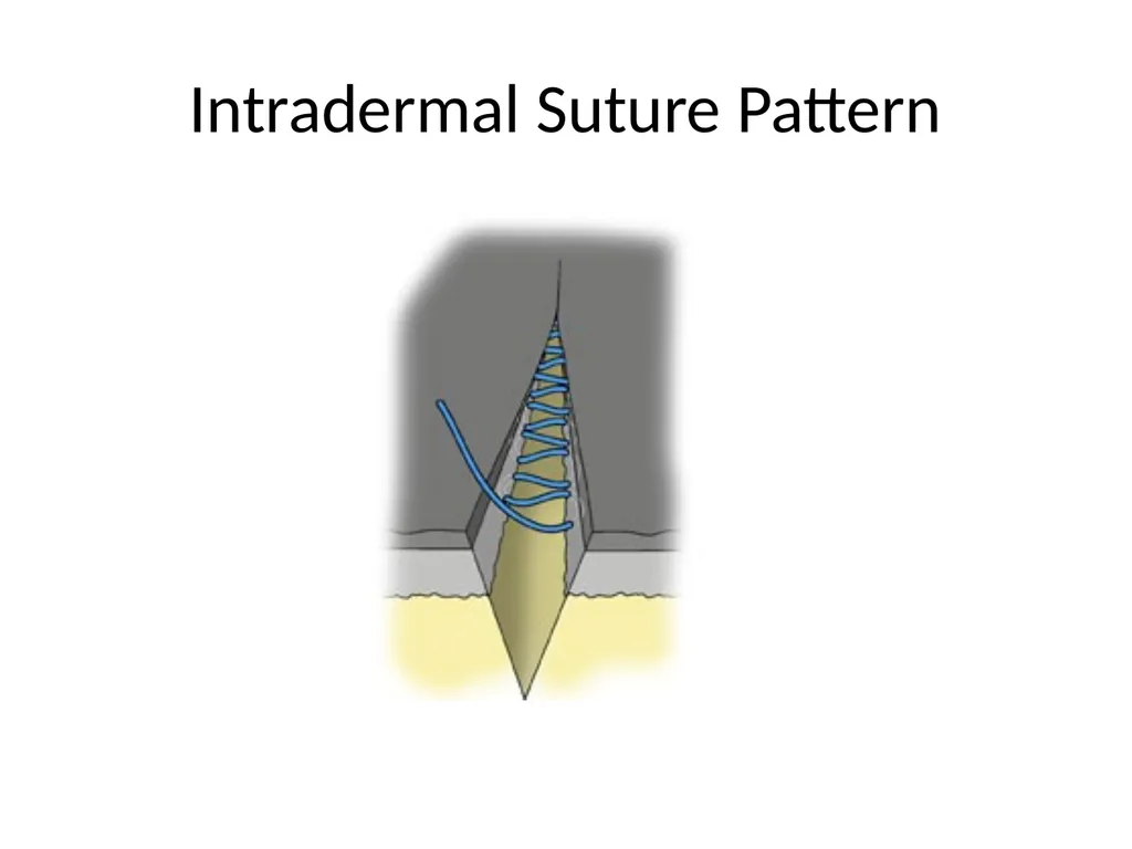 Advanced Suturing for RVNs Zamantha Marshall - slide 23 of 27