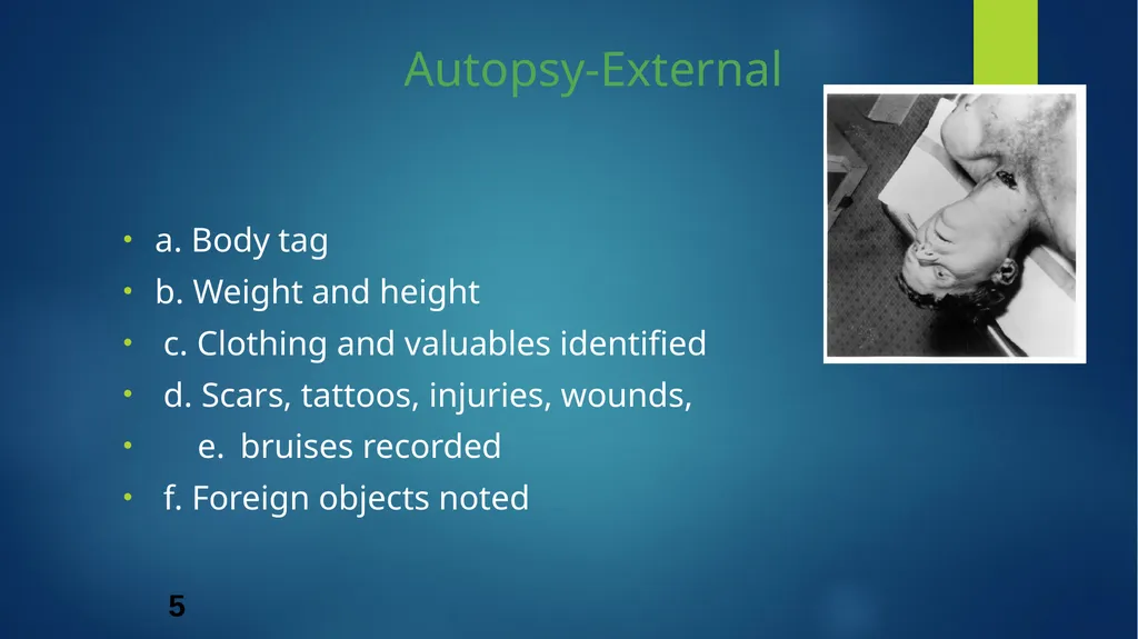 Post mortem methods Postmortem method Learning out - slide 5 of 29