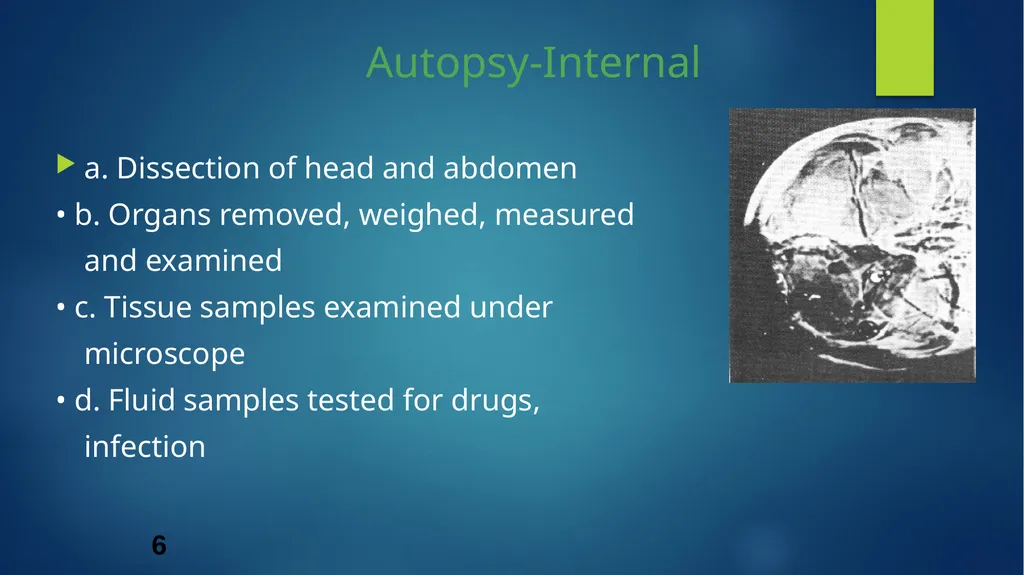 Post mortem methods Postmortem method Learning out - slide 6 of 29