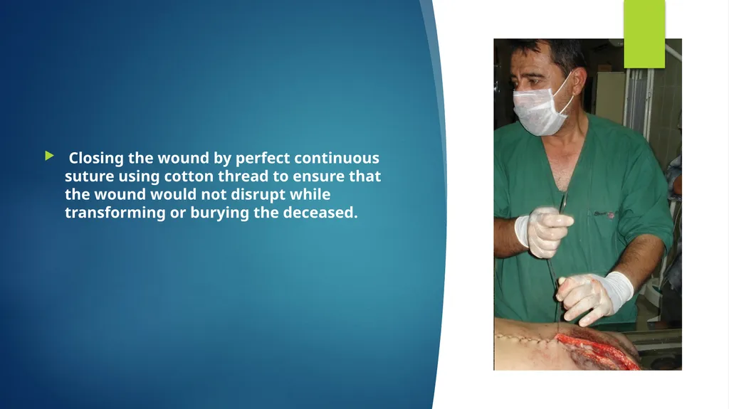 Post mortem methods Postmortem method Learning out - slide 26 of 29