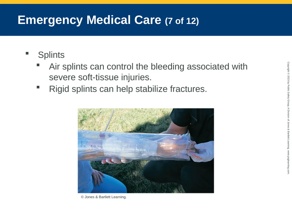 Bleeding CHAPTER 27: Focused Lecture National EMS - slide 29 of 34